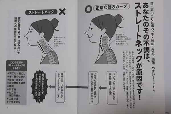 あなたの首の痛み 肩こりはストレートネックが原因です 酒井慎太郎著 本とパソコンのある暮らし